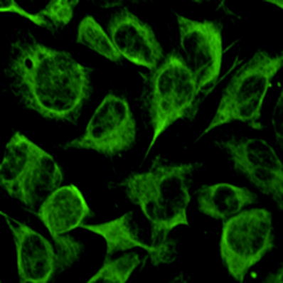 NS Reagents TDP43 Antibody (Cat-AA17-100105) Image 1